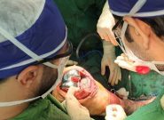 نخستین عمل جراحی تعویض مفصل زانو در مراغه انجام شد
